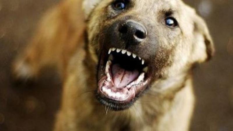 Bakıda it 3 yaşlı uşağın qulağını qopardı