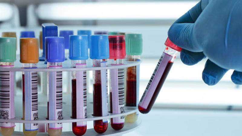 3600-dən çox talassemiya daşıyıcısı aşkar edildi