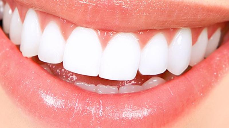 Dişlərinizin sağlamlığı üçün bu qidalardan UZAQ OLUN