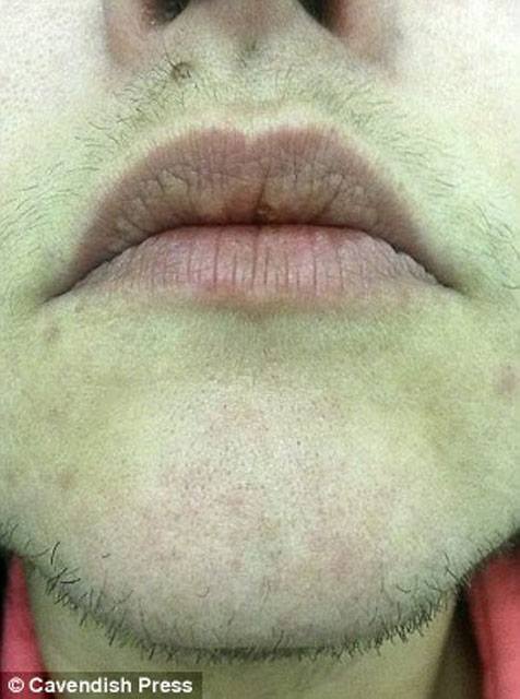 Bu qadınlar üzünü gündə 3 dəfə qırxmaq məcburiyyətində qalır - FOTOLAR