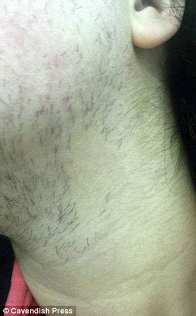 Bu qadınlar üzünü gündə 3 dəfə qırxmaq məcburiyyətində qalır - FOTOLAR