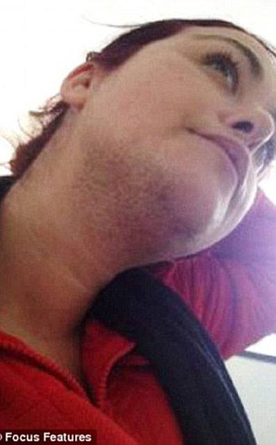 Bu qadınlar üzünü gündə 3 dəfə qırxmaq məcburiyyətində qalır - FOTOLAR