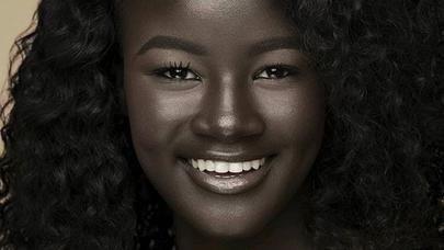 Bu gözəl dərisinin rəngi ilə hər kəsi təəccübləndirir - - FOTOLAR