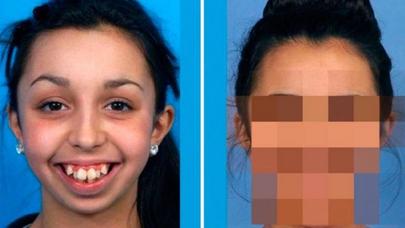 Özünü eybəcər sayan qız o qədər dəyişdi ki... - FOTOLAR