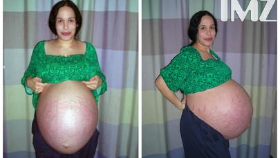 Bu qadının indiki halı görənləri şoka salır - FOTOLAR