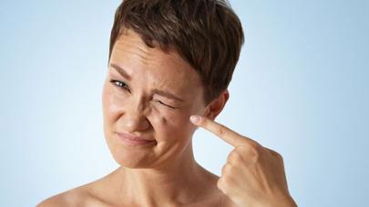 Gözaltı qırışlarından azad olmağın yolları - - FOTO