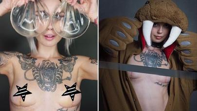 Slikon implantlar çıxarılanda qadın sinəsi necə görünür? – FOTOLAR