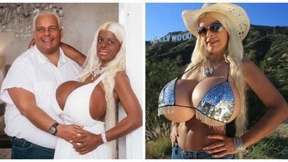 Avropanın ən iri sinəli qadını 120 mini bunun üçün xərclədi - FOTOLAR