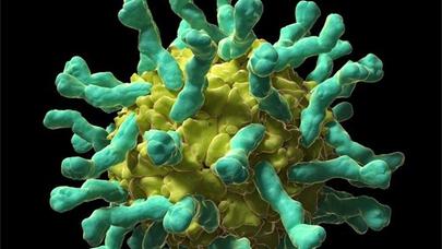 ÜST açıqladı: vəba səbəbindən 300-dən çox insan ölüb