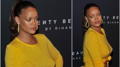 Sürətlə kökələn Rihannanın YENİ HALI - FOTO