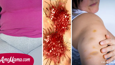 Qadınların əhəmiyyət vermədiyi AĞRILAR - Bu 12 hal xərçəngin ƏLAMƏTİDİR