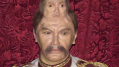 İkibaşlı adamın DƏHŞƏTLİ HƏYAT HEKAYƏSİ: çox TƏSİRLİDİR - FOTO