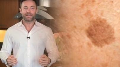 Soğan və sirkəni bir-birinə qataraq BUNU EDİN! - 7 gün sonra MÖCÜZƏVİ NƏTİCƏ