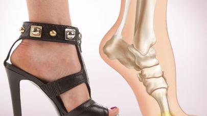 Qadınlarda ayaq ölçüləri niyə tez-tez dəyişir? - MARAQLI SƏBƏBLƏR - - FOTO