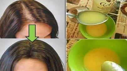 Saç tökülməsinə qarşı YENİ ÜSUL