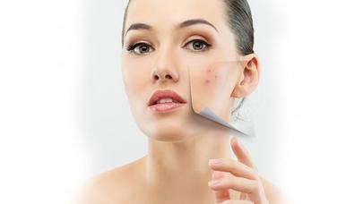Təmiz üz dərisinə sahib olmağın SİRRİ - ASAN RESEPT