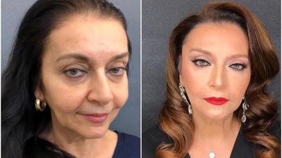 Həmidə Ömərova tanınmaz hala düşdü - - FOTO/VİDEO