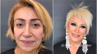 Mədəsini kiçildib, 15 kq arıqlayan aktrisanı TANIMAYACAQSINIZ – VİDEO