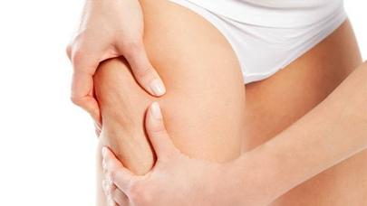 Sellülitləri birdəfəlik yox edən TƏBİİ VASİTƏ