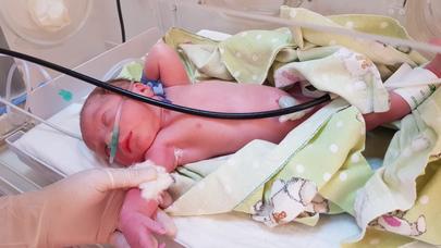 Dünya səhiyyəsində ilk: Azərbaycanlı professordan MÖHTƏŞƏM YENİLİK - FOTOLAR