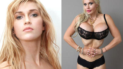 200 estetik əməliyyat keçirən qadının son istəyi həkimləri ŞOKA SALDI – FOTO