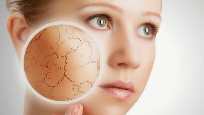 Dərinizi bu möcüzə ilə şaxtadan qoruyun - RESEPT