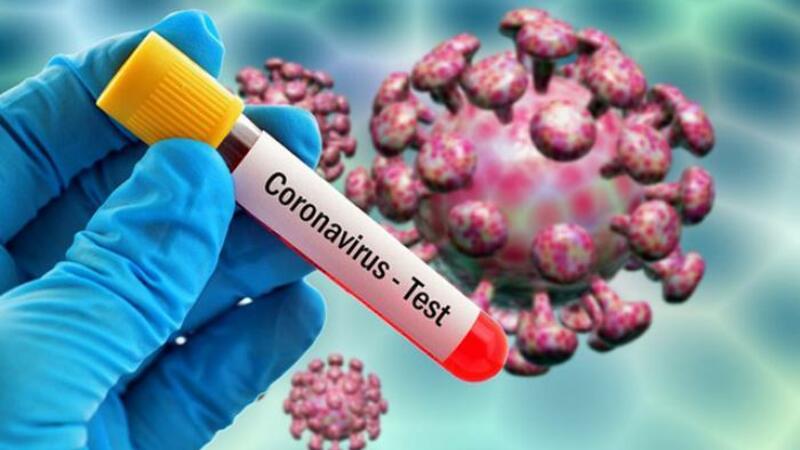 Azərbaycanda daha 61 nəfər koronavirusa yoluxdu