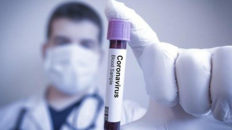 Koronavirusa yoluxanların sayı  6 000 000-a yaxınlaşır -