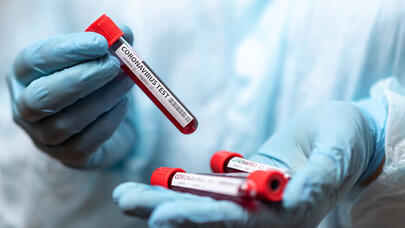 Yoluxanların sayı açıqlandı - FOTO