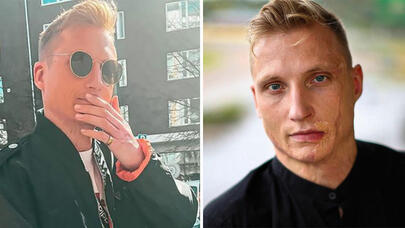 Qəzada dərimin 70 faizi yandı - Məşhur musiqiçidən ŞOK SÖZLƏR