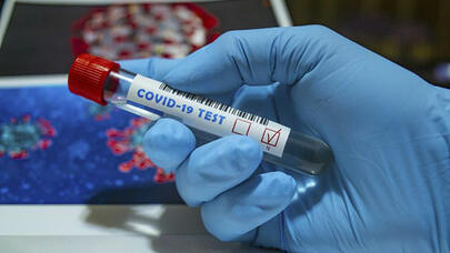 Yoluxanların sayı açıqlandı - FOTO