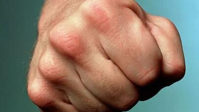 Deputat məhkəməyə verildi: Arvadının burnunu sındırıb