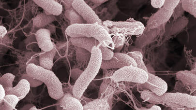 ÜST-dən yüksək sürətlə yayılan xəstəlik barədə BƏYANAT