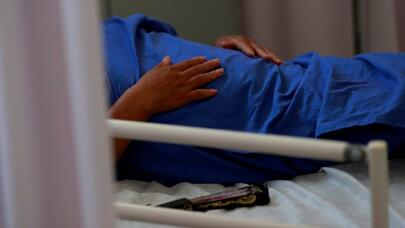 84 yaşlı qadının qarnında 40 yaşlı döl tapıldı