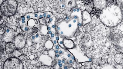 Virusoloq nöqtəni qoydu: "Daha təhlükəli mutasiyalar yarana bilməz"