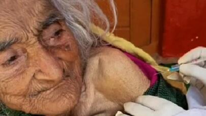 80 il beynində iynə ilə yaşadı - Heç vaxt başı ağrımadı