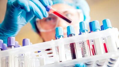 Alimlərdən yeni kəşf: neçə il yaşayacağınız bu analizlə müəyyən ediləcək - Video