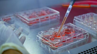 Xərçəngə qarşı yeni bioloji preparat yaradıldı