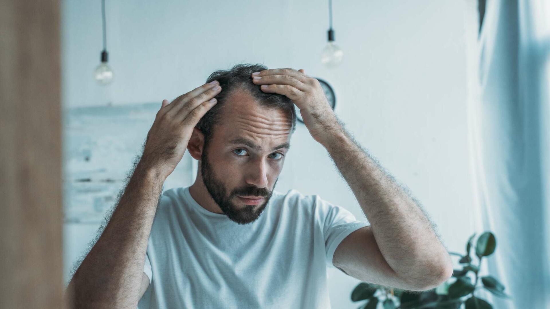 Kişilərdə erkən saç ağarmasının əsas səbəbi