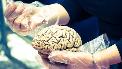 Dünyada ilk: bu anbarda insan beyni saxlanılacaq