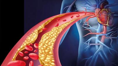 Ürək-damar xəstəlikləri ilə mübarizədə sıçrayış olacaq - Yeni kəşf