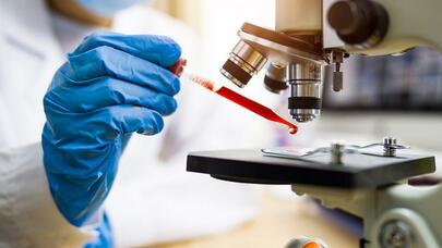 Tez və yavaş qocalan orqanlar belə müəyyən ediləcək