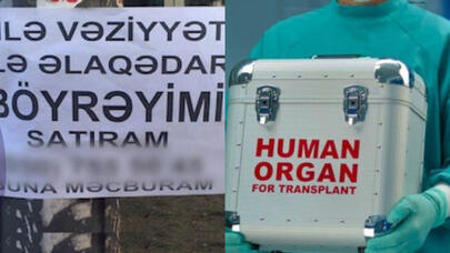 Orqan satışı elanlarını yayanlar kimlərdir? - VİDEO