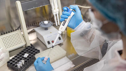 Son 30 ildə İLK: insanda at ensefaliti qeydə alındı