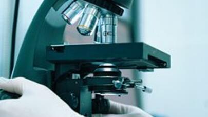 18 illik sirr açıldı: Qatil "T" hüceyrələri...