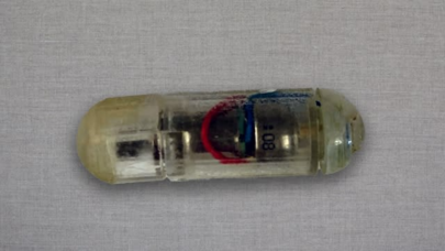 Tibbdə YENİ İNQİLAB: "Ağıllı" həb mədədə titrəyəcək və... - FOTO