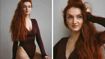 Saçların rənginə görə xəstəliklər: sarışın, qaraşın, qumral...