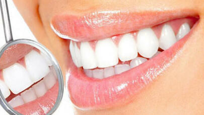 Dişləriniz nə qədər ömür sürəcəyinizi göstərir