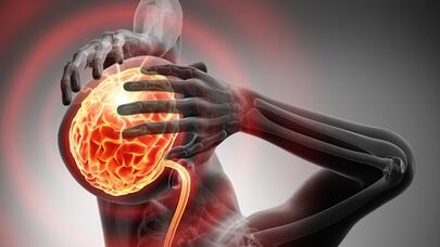 Baş ağrısına nə səbəb olur?