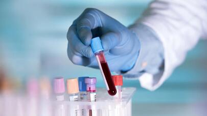 Nadir tapılan qan qrupu aşkarlandı: Dünyada yalnız...